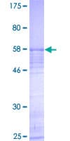Human NOL7 / RARG-1 Protein (Recombinant GST)