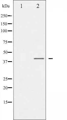 CCR5 Antibody (phospho-Ser336)