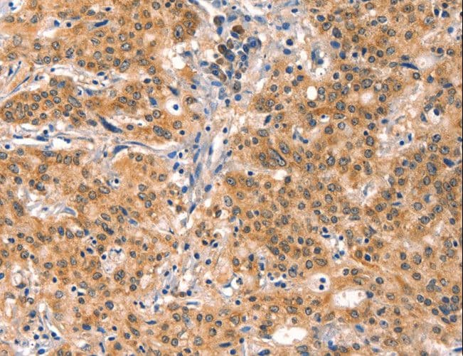 EIF4G1 / EIF4G Antibody