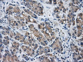 Monoclonal Mouse anti-Human AKR1A1 Antibody (clone OTI9F1, IHC, WB)