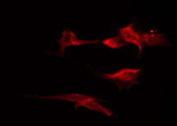 CA12 / Carbonic Anhydrase XII Antibody