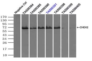 Monoclonal Mouse anti-Human CHEK2 / CHK2 Antibody (clone OTI5C7, IHC, WB)