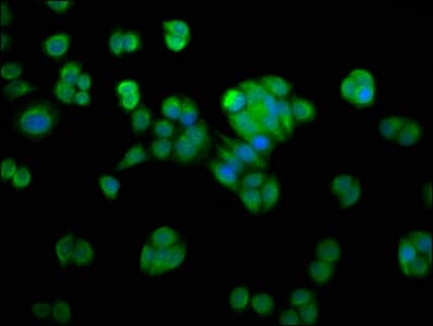 Polyclonal Rabbit anti-Human NMRAL1 / HSCARG Antibody (WB)