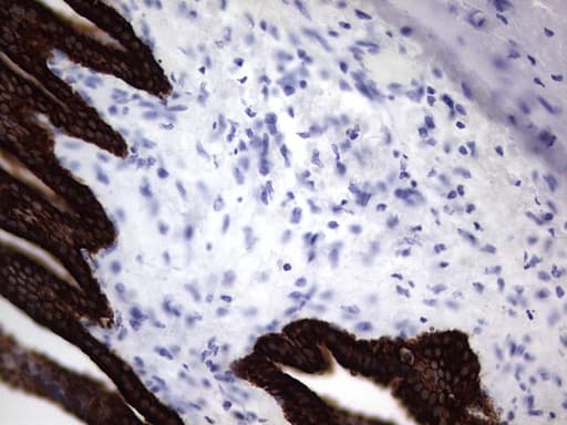 KRT19 / CK19 / Cytokeratin 19 Antibody (aa240-390, clone OTI8A1)