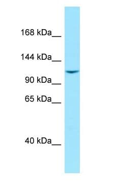 LIMCH1 Antibody (aa954-1003)