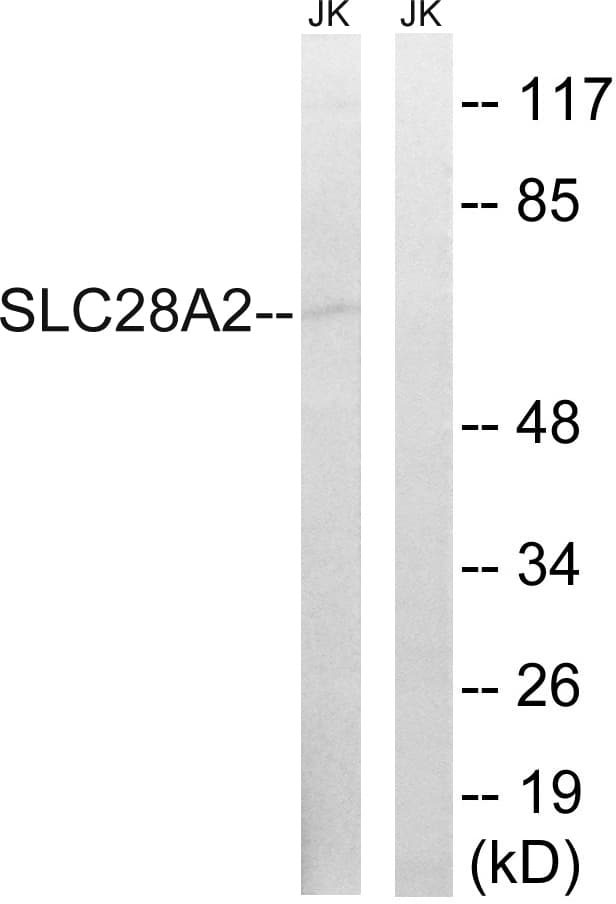 SLC28A2 Antibody (aa371-420)