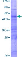 Human OR9G4 Protein (Recombinant GST)