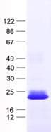 Human GCAP2 / GUCA1B Protein (Recombinant His, N-Terminal)