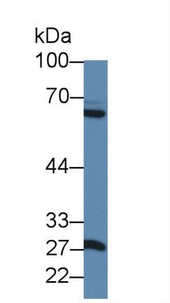 MMP1 Antibody (aa169-464)