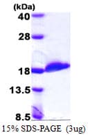 Human UBE2D2 / UBCH5B Protein (Recombinant His)