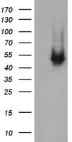 CATIP / C2orf62 Antibody (clone OTI2F4)