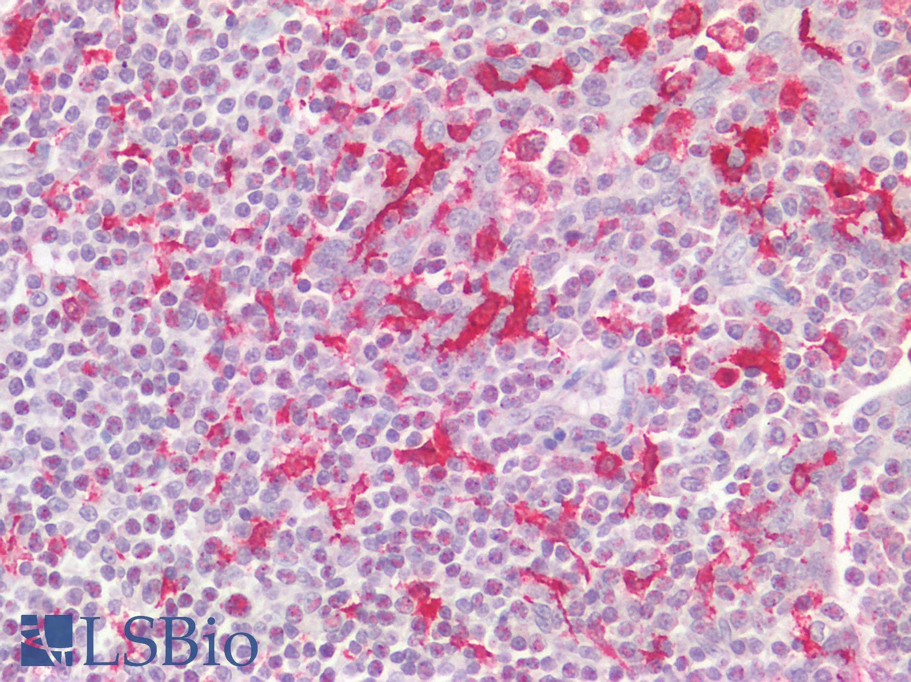 IHC-plus™ AIF1 / IBA1 Antibody (C-terminal domain of human)