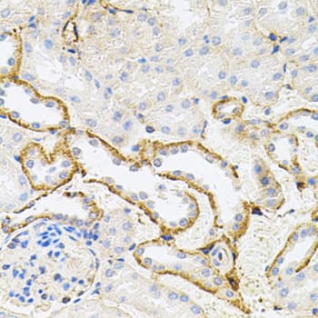 RPS6KA3 / RSK2 Antibody