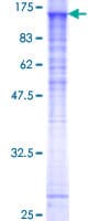 Human SNX19 Protein (Recombinant GST)