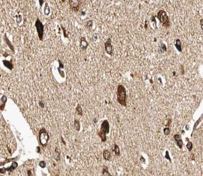 GUCY1B3 Antibody