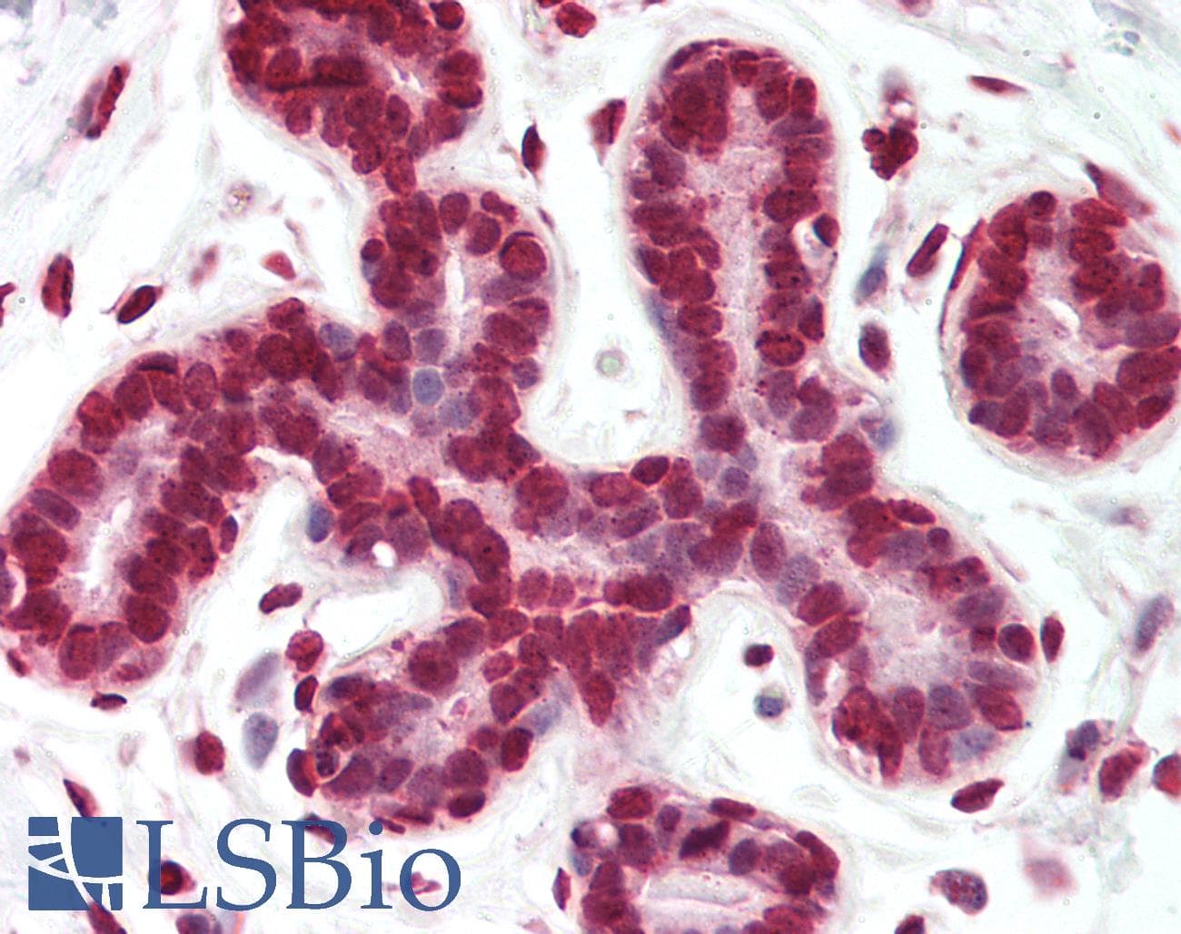 IHC-plus™ DAPK3 / ZIP Kinase Antibody (aa255-282)