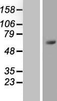 ZNF496 / NZIP1 Protein (Over-Expression Lysate Myc-DDK (Flag))