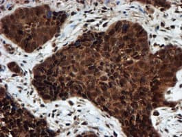 PSMA6 Antibody (clone OTI5H3)