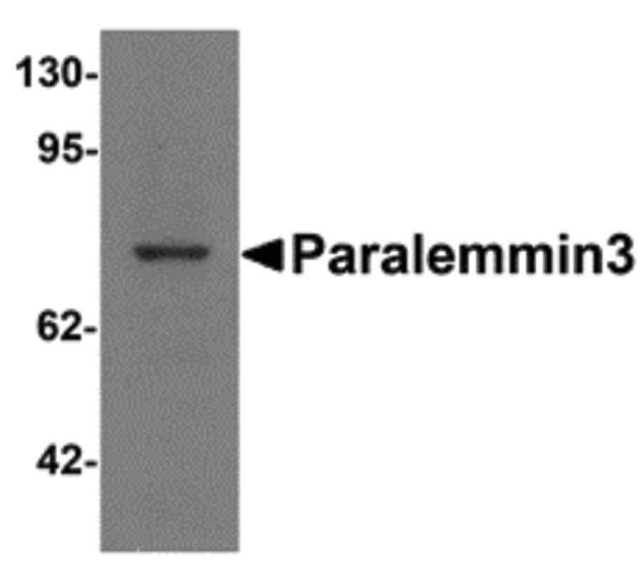 IHC-plus™ Polyclonal Rabbit anti-Human Paralemmin 3 / PALM3 Antibody (IHC, IF, WB)