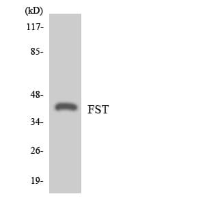 IHC-plus™ FST / Follistatin Antibody (aa114-163)