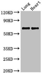 POLL / DNA Polymerase Lambda Antibody