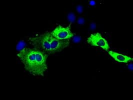 IGF2BP2 Antibody (clone OTI3C8)