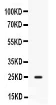 Polyclonal Rabbit anti-Mouse CD9 Antibody (IHC, WB)