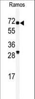 Polyclonal Rabbit anti-Human RIOK2 Antibody (aa401-430, WB)