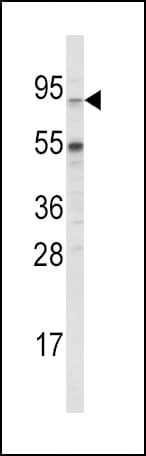 ABCG1 Antibody (aa359-387)