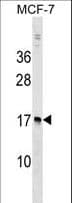 Polyclonal Rabbit anti-Human NUDT4 Antibody (aa1-30, WB)