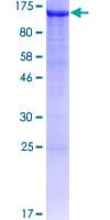 Human AP1B1 / BAM22 Protein (Recombinant GST)