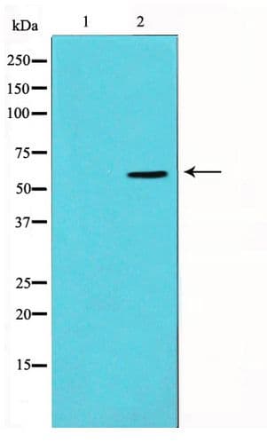 Polyclonal Rabbit anti-Human Vimentin Antibody (IHC, WB)