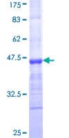 Human MMRN1 Protein (Recombinant GST, N-terminus)