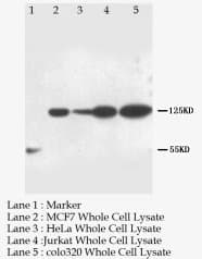 NOTCH1 Antibody (Internal)