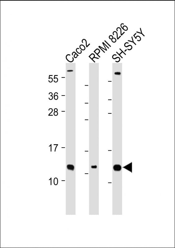 CKS2 Antibody (N-Terminus)