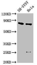 IHC-plus™ CTNNB1 / Beta Catenin Antibody