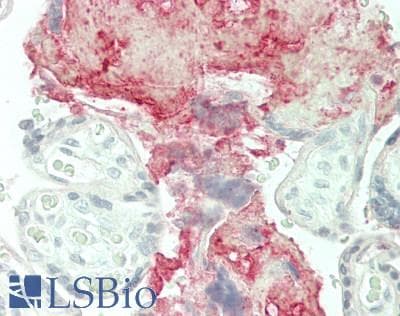 IHC-plus™ Polyclonal Rabbit anti-Human CLU / Clusterin Antibody (Glu436, IHC, IF, WB)