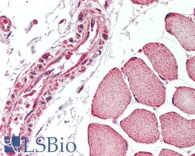 IHC-plus™ Polyclonal Rabbit anti-Human MER / MERTK Antibody (aa840-999, IHC, WB)