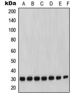 MMP7 / Matrilysin Antibody (C-Terminus)