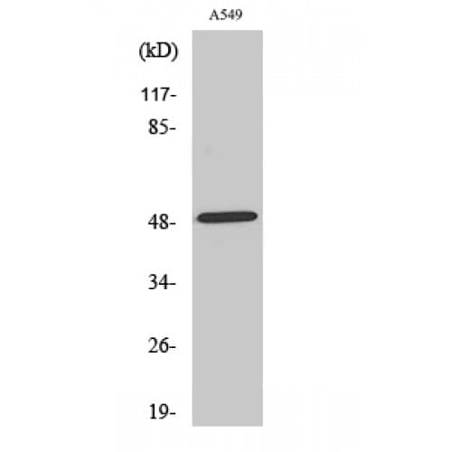 Polyclonal Rabbit anti-Human IOP1 / NARFL Antibody (360-440 aa, C-terminal, IHC, WB)