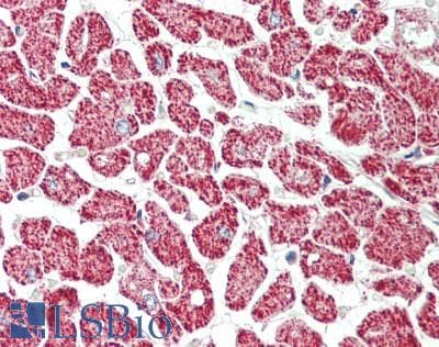 Polyclonal Rabbit anti-Human KCNIP2 / KCHIP2 Antibody (aa35-84, IHC, WB)