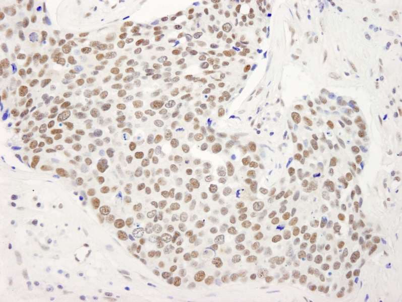 Polyclonal Rabbit anti-Human BANP Antibody (aa425-C-term, IHC)