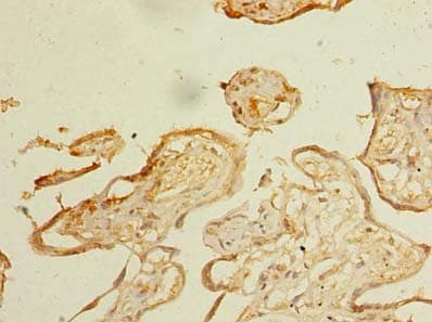 IHC-plus™ Polyclonal Rabbit anti-Human ZDHHC3 Antibody (IHC, WB)