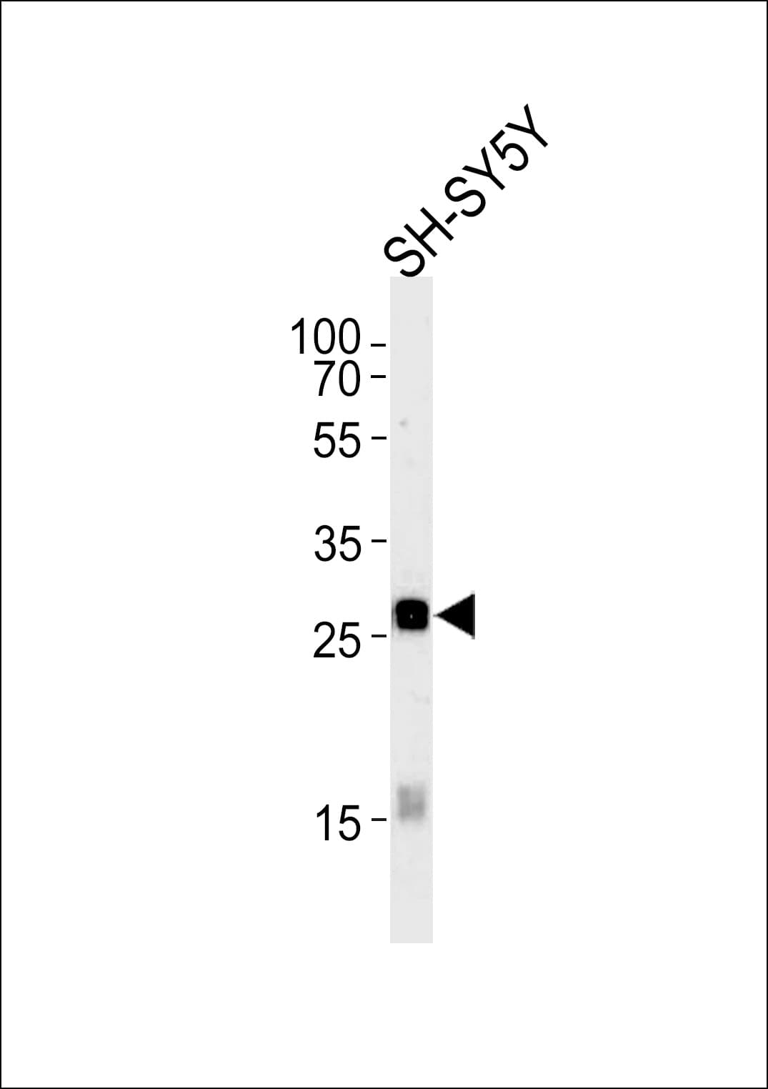 IHC-plus™ GPM6A / Glycoprotein M6A Antibody (aa232-259)
