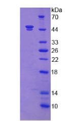 Mouse FGF7 / KGF Protein (Recombinant His-GST)