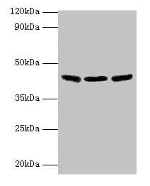 IHC-plus™ IDH3B Antibody