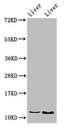 Polyclonal Rabbit anti-Human DDA1 Antibody (IHC, IF, WB)