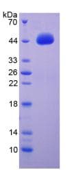 Mouse BDNF Protein (Recombinant His-GST)