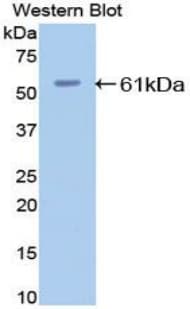ESR2 / ER Beta Antibody (aa1-530, FITC)