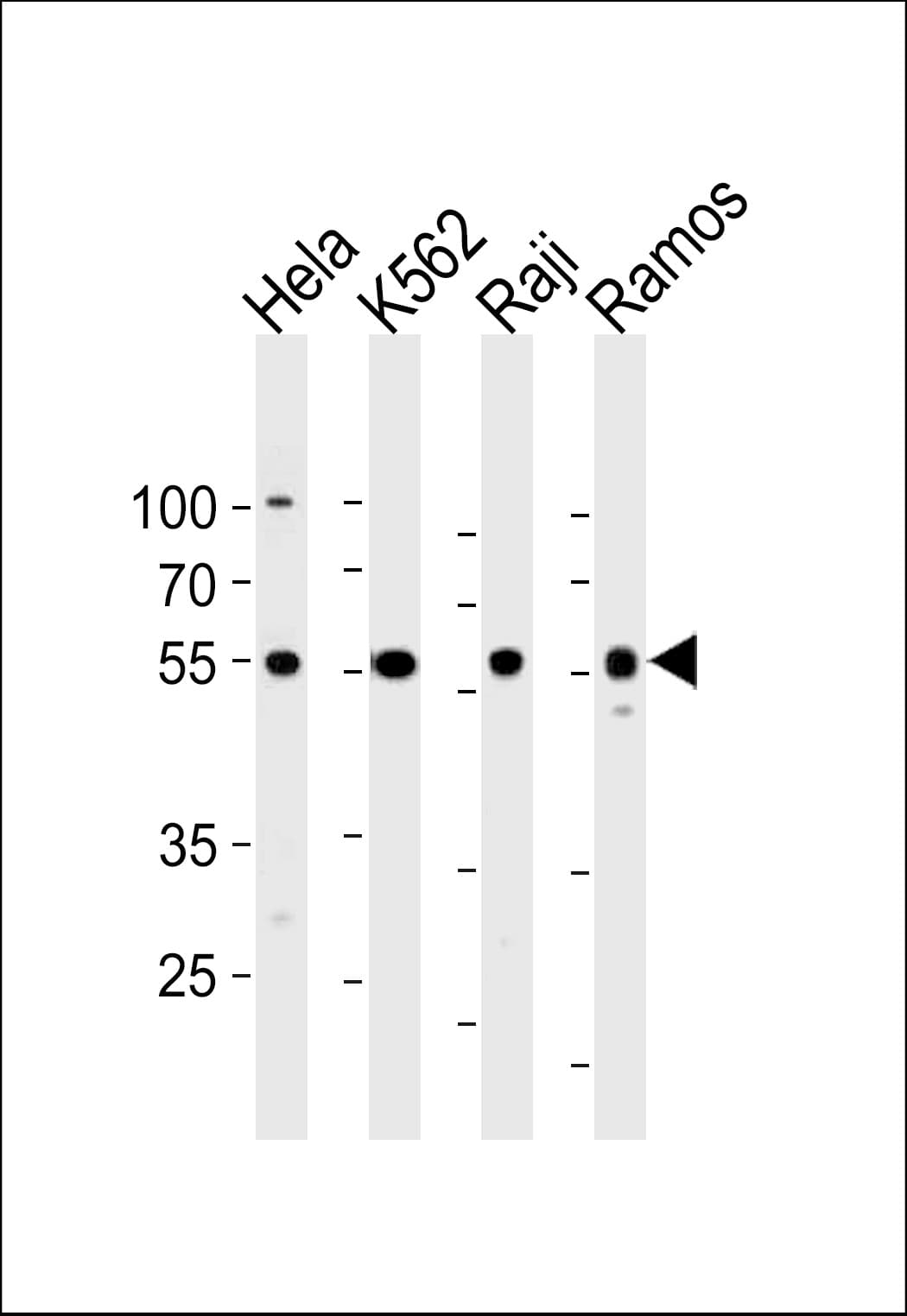 Polyclonal Rabbit anti-Human RELA / NFKB p65 Antibody (aa166-195, IF, WB)
